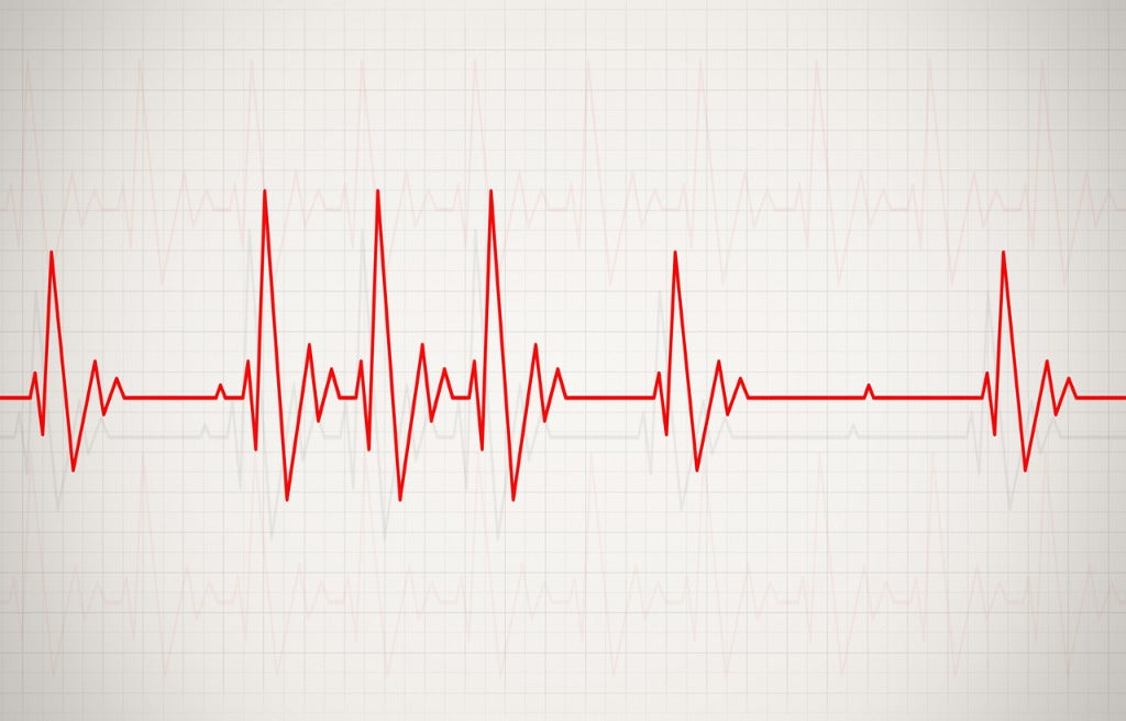 Arrhythmias are disruptions in your heart's usual beat. This can show up as beats that are too fast, too slow, or irregular, and are commonly experienced as palpitations