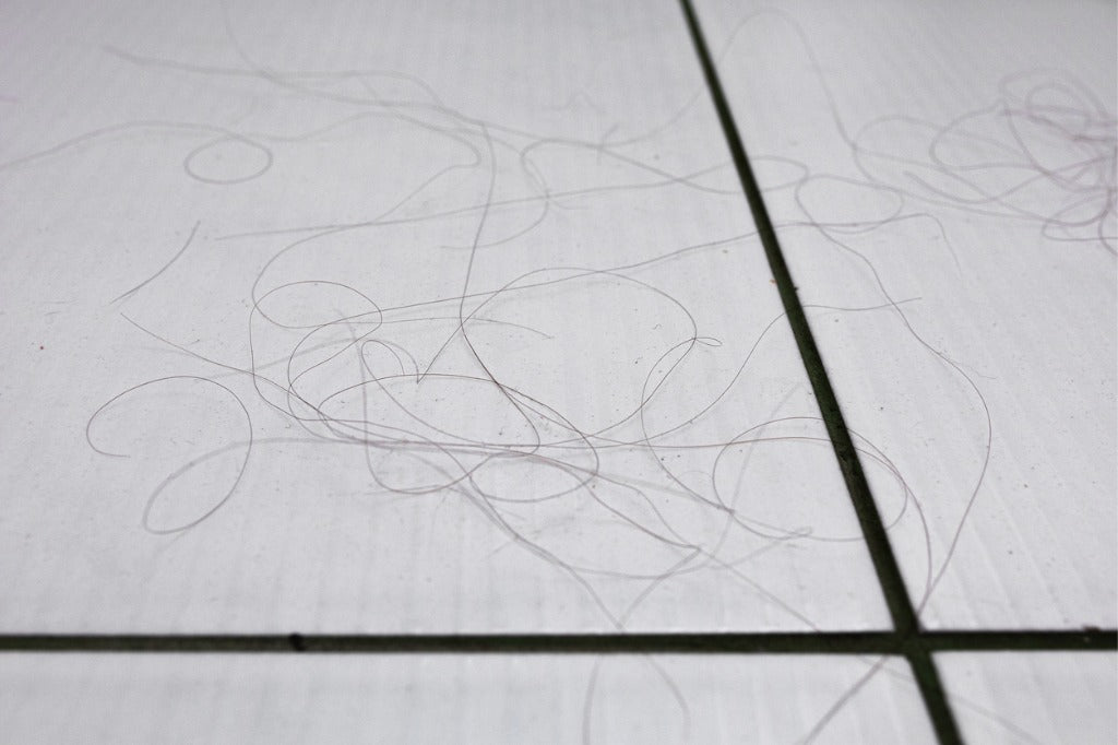 Hair loss in Women: causes and treatment