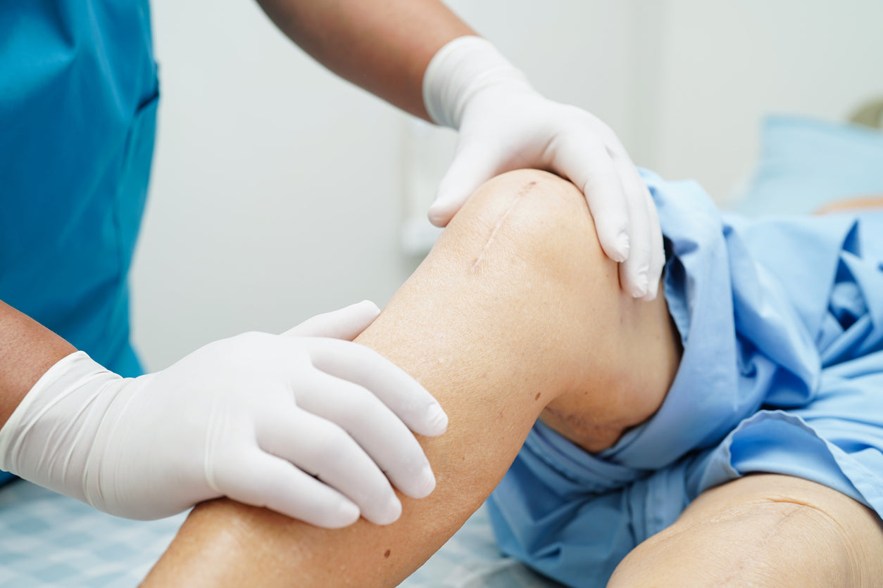Knee Replacement Surgery: Tips to Prepare and Recover Faster