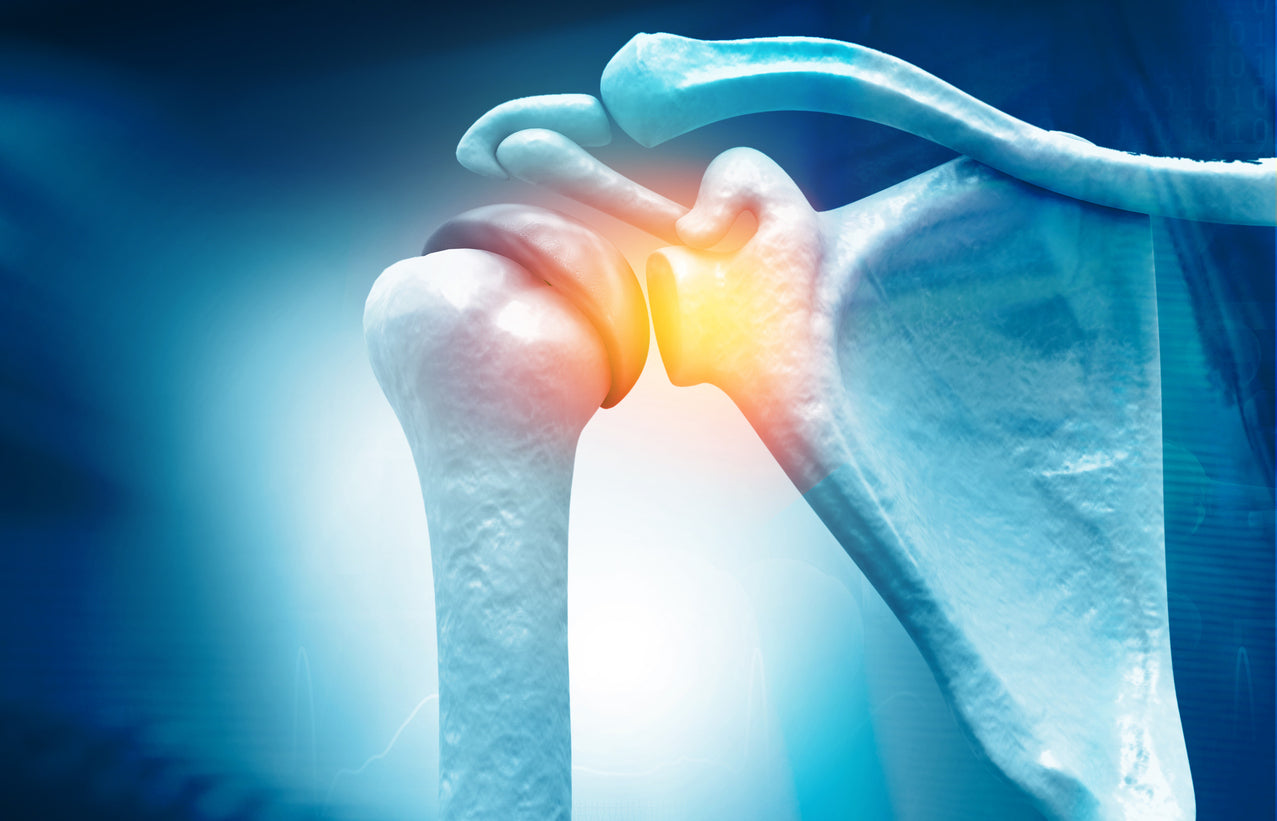 Rotator Cuff Problems After 50: Does a Tear Always Need Surgery?